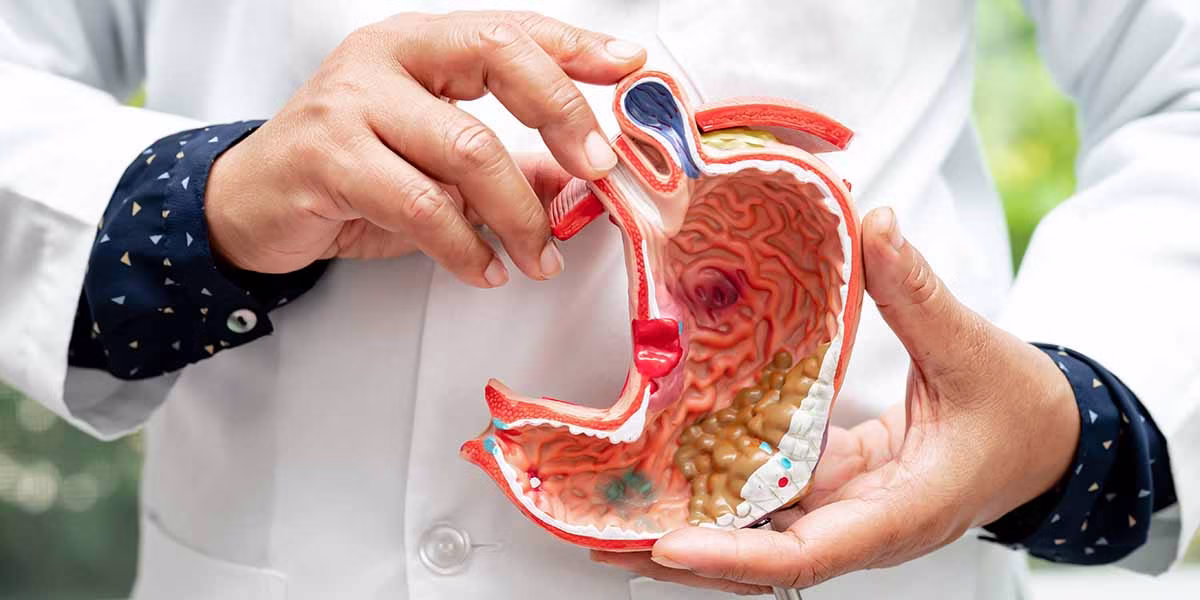 Stomach disease, doctor holding anatomy model for study diagnosi „Minimalinvasive Leistenbruch-OP in Berlin-Mitte nahe Checkpoint Charlie – Venaziel Zentrum“