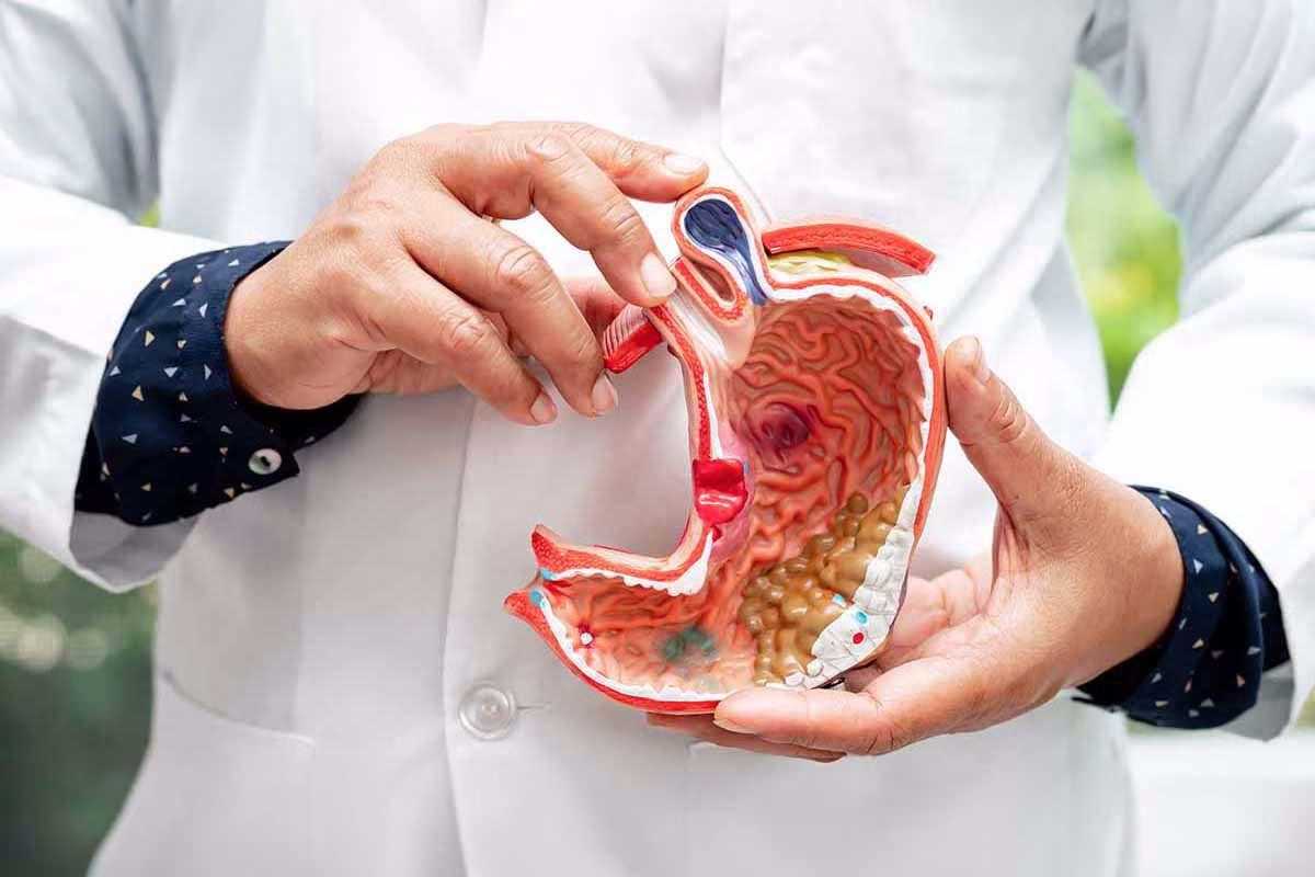 Stomach disease, doctor holding anatomy model for study diagnosi Leistenbruch-inguinalhernie-minimalinvasive-op-berlin-mitte-checkpoint-charlie-venaziel-mvz