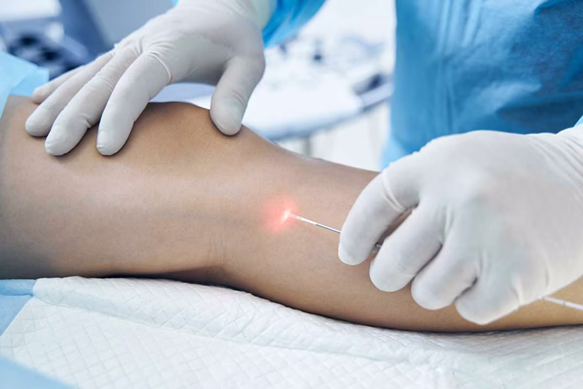 doctor-phlebologist-is-performing-endovenous-laser-therapy-in-veincenter-berlin-venaziel-venenzentrum doctor phlebologist is performing endovenous laser therapy in veincenter berlin venaziel venenzentrum